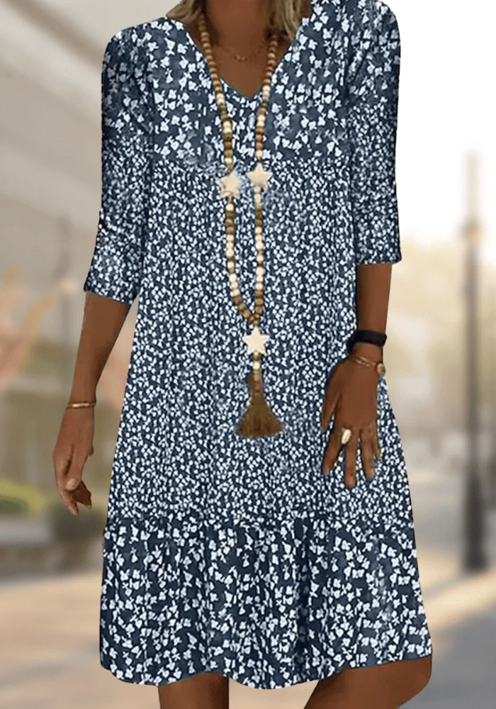 Women’s Printed Casual Dress | Mini